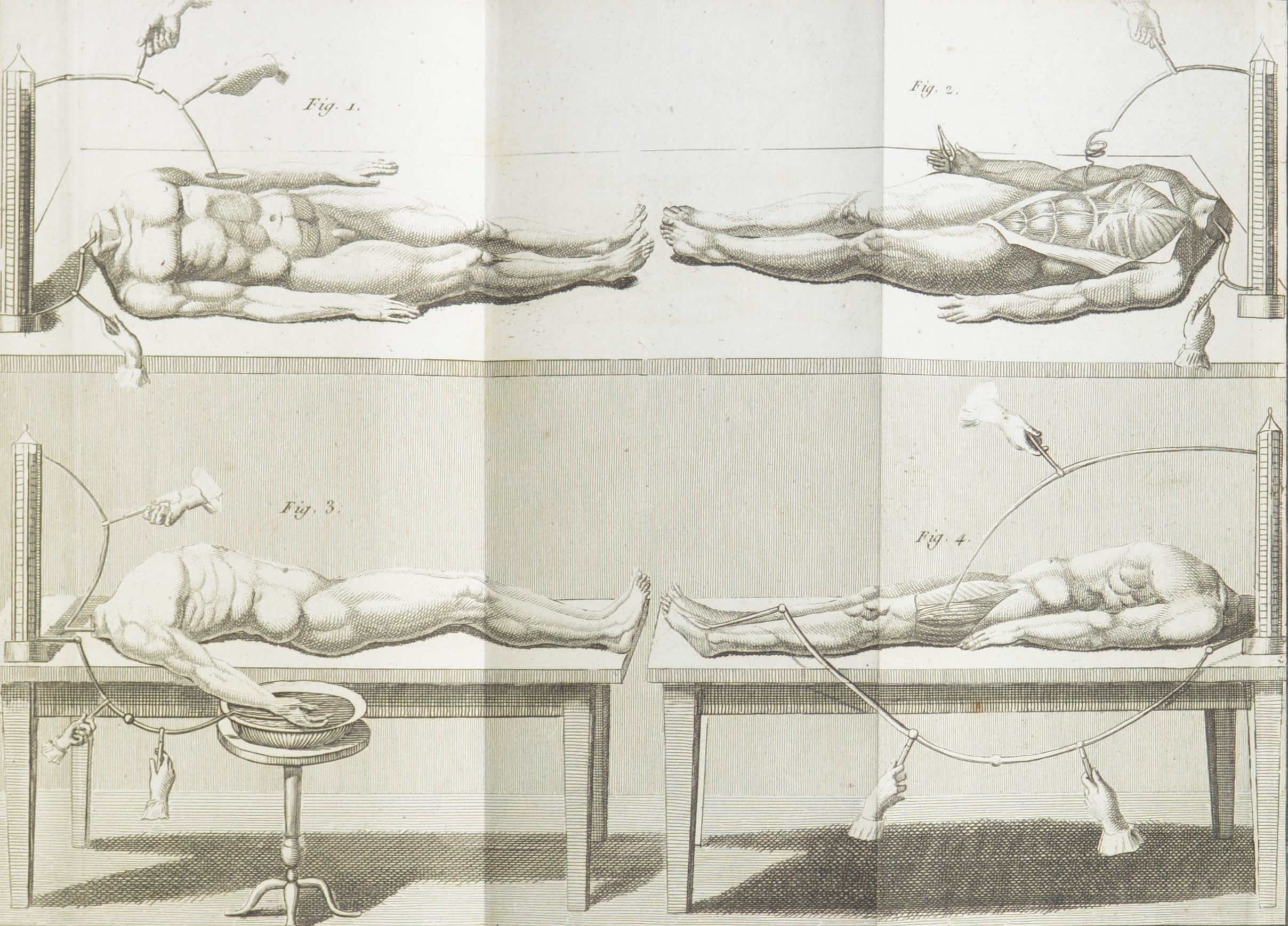 Dr Frankenstein: Cadavers from French Aldini