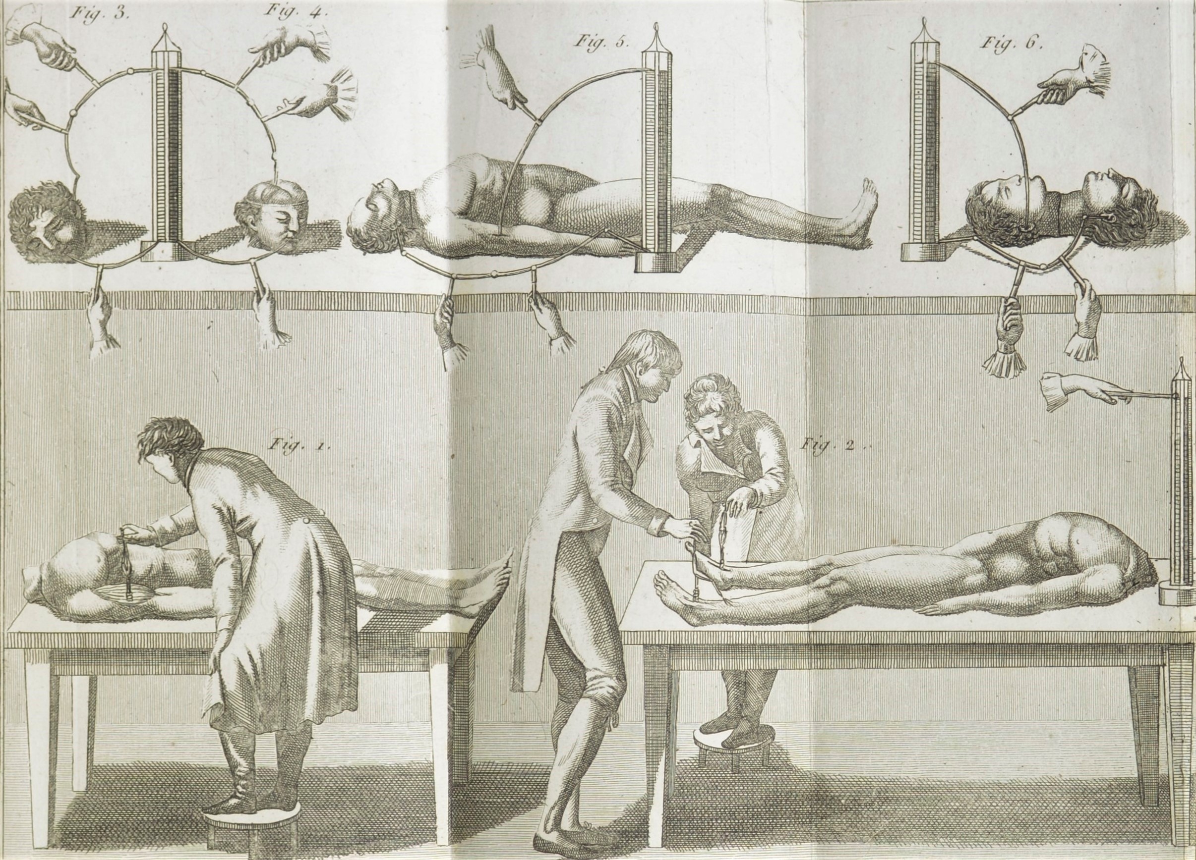 Dr Frankenstein: French Aldini full plate